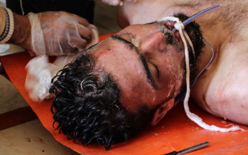 Korban Tewas Serangan Gas Beracun Suriah Bertambah 