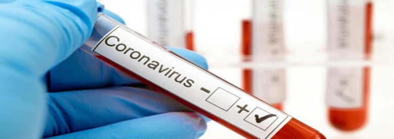 Paska Diumumkannya Warga Inhu Dinyatakan Positif Covid-19,Masyarakat Diminta Tidak Panik