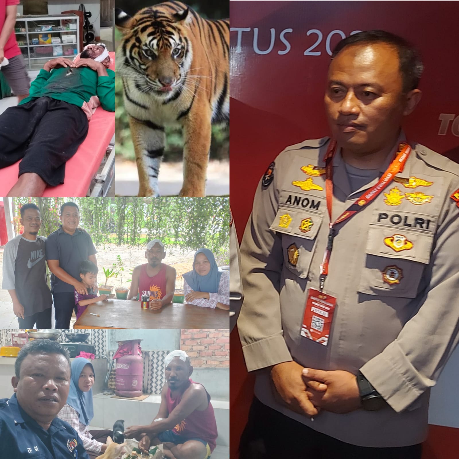Pekerja HTI PT Arara Abadi Diterkam Harimau Sumatera, Korban Selamat Setelah Dirawat di RS